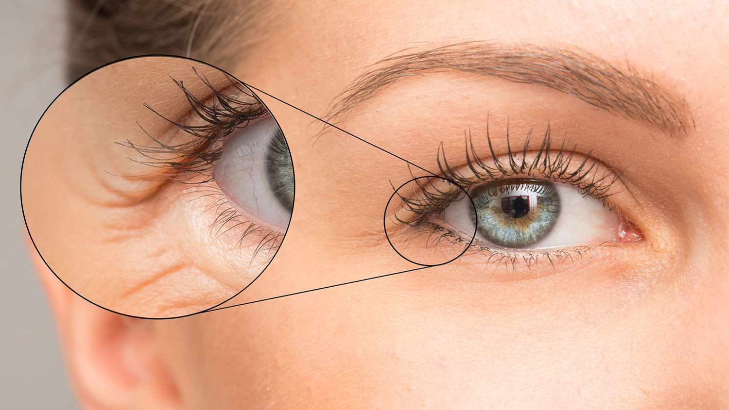 Kırışıklıkları Yok Edebilirsiniz