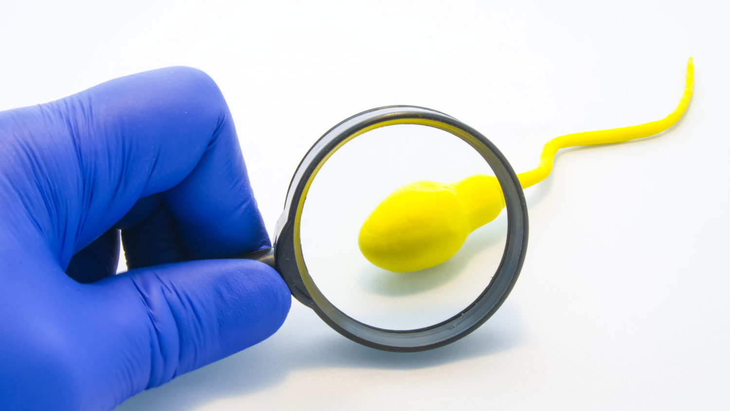 Sperm Sayılarındaki Düşüş Devam Ediyor