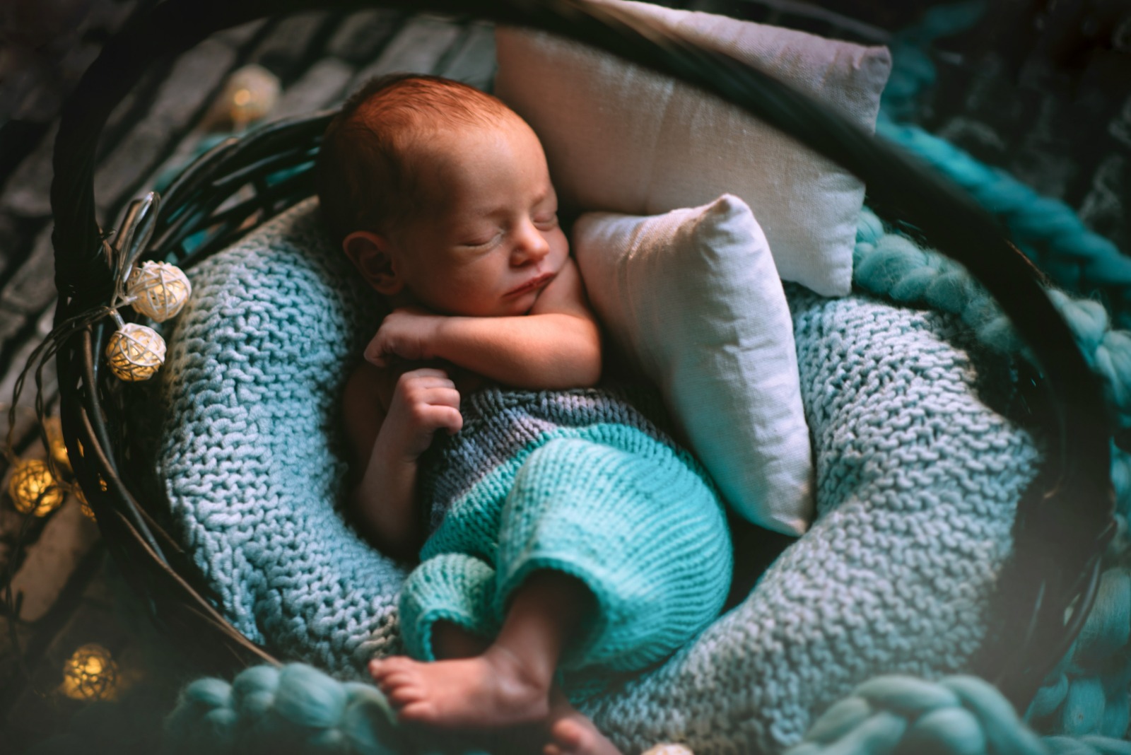 El Ve Ayak Anomalileri