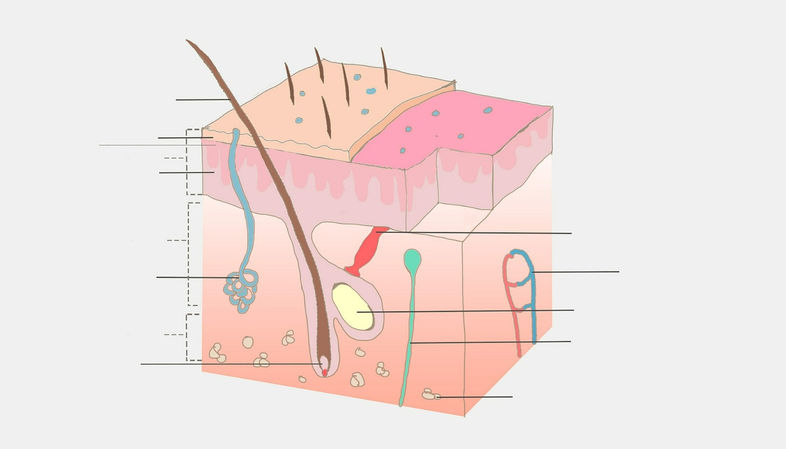 Ektodermal Displazi (Ectodermal Dysplasia)