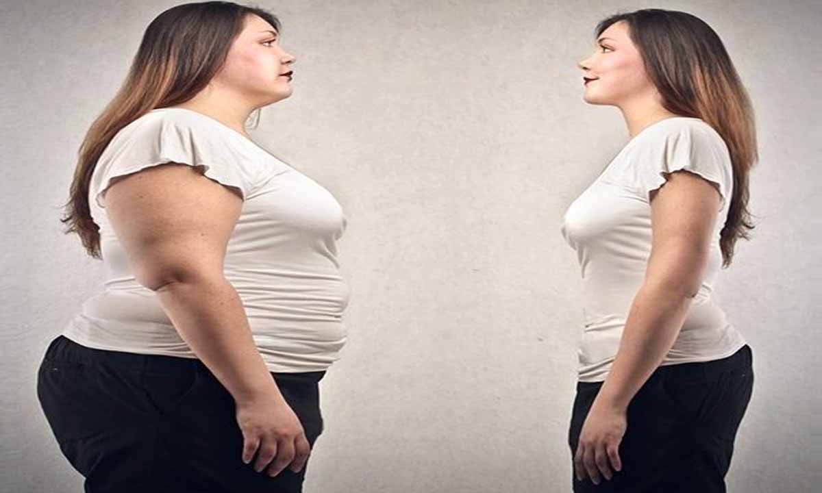 Obezite Cerrahisinde Yöntem Seçimi