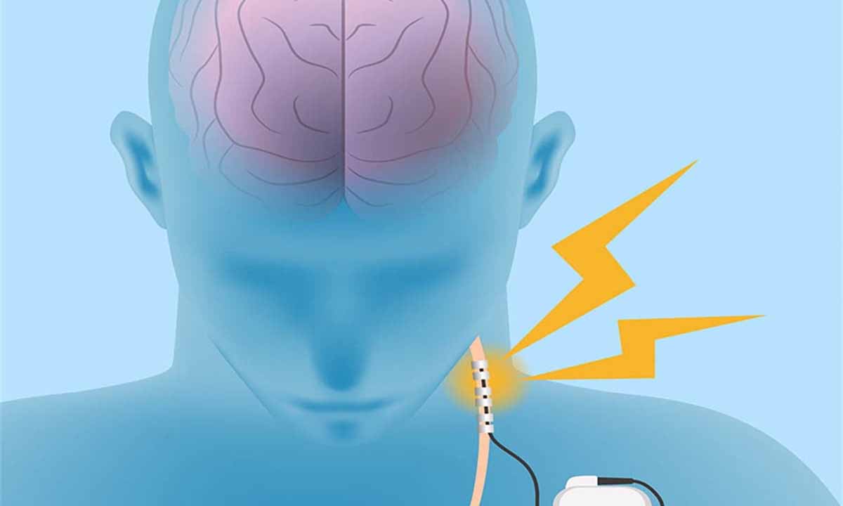 Obezite Vagal Sinirleri Tahrip Ediyor!