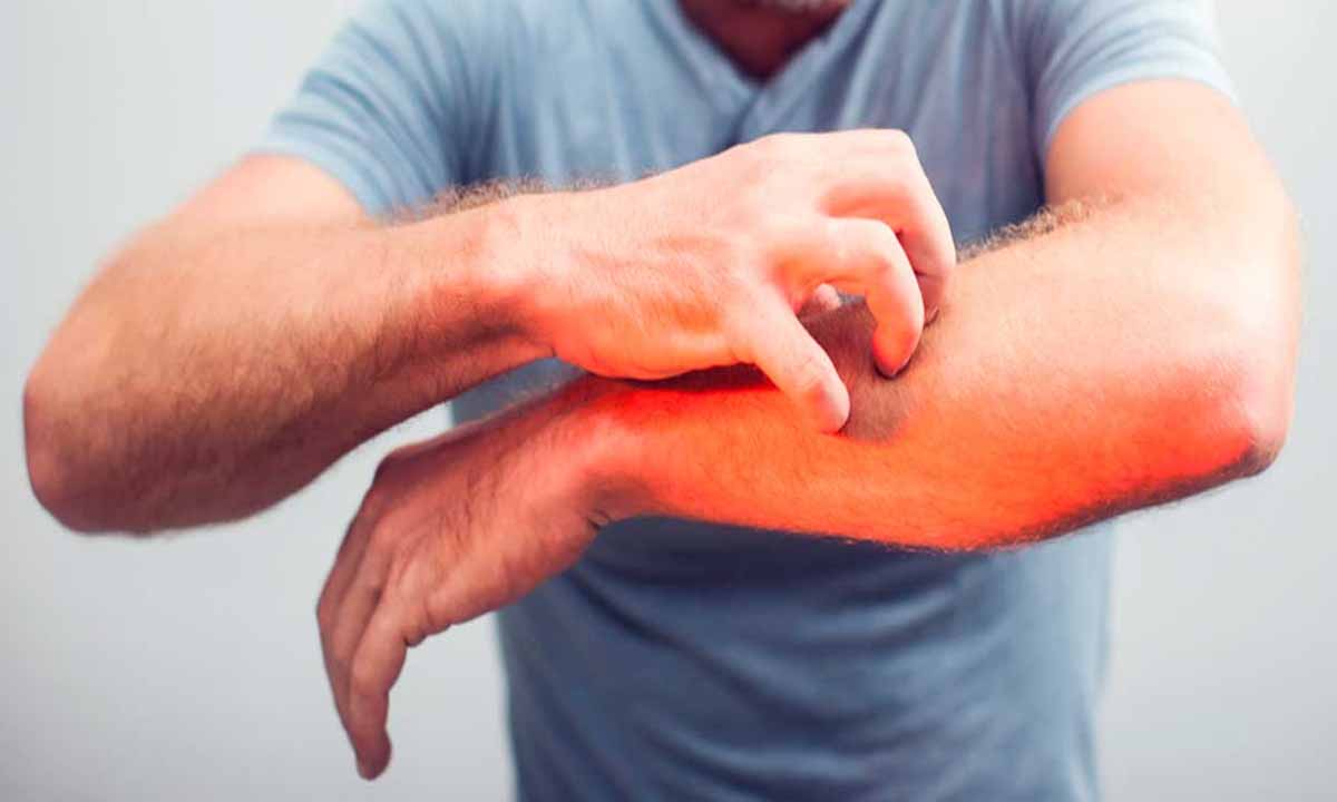 Kaşıntının Nedeni