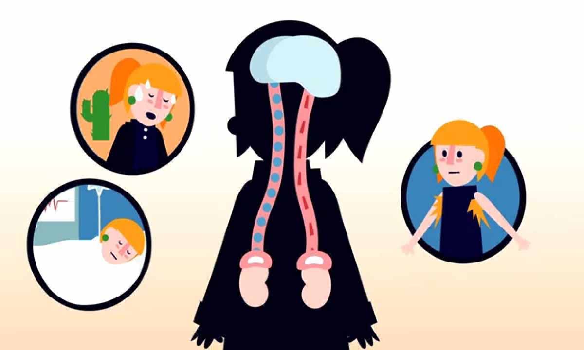 Konjenital Adrenal Hiperplazi