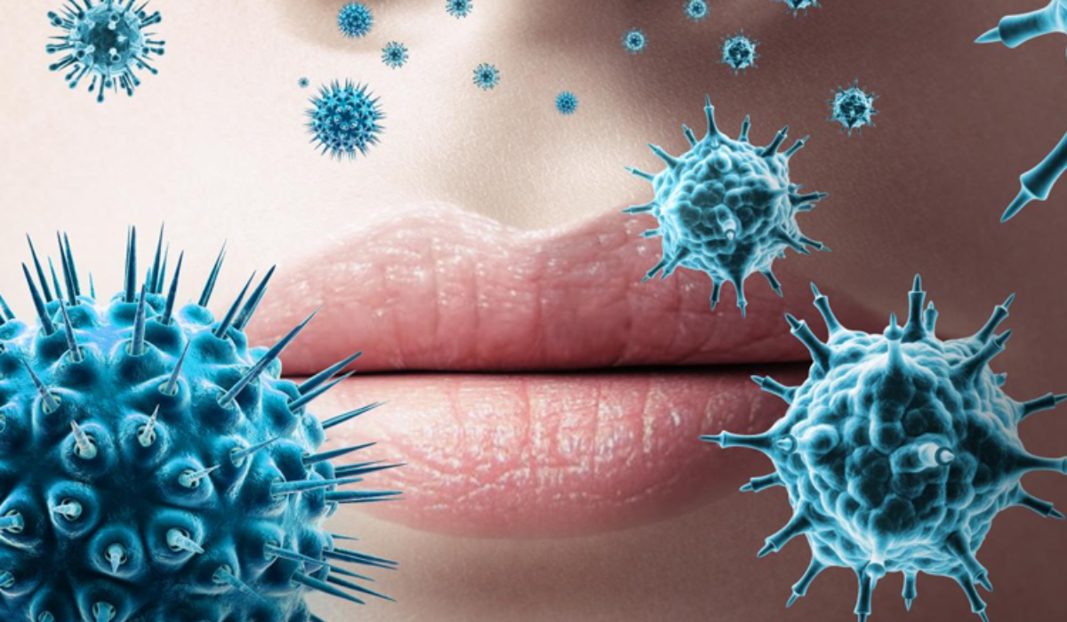 Herpes Simpleks Hastalığı