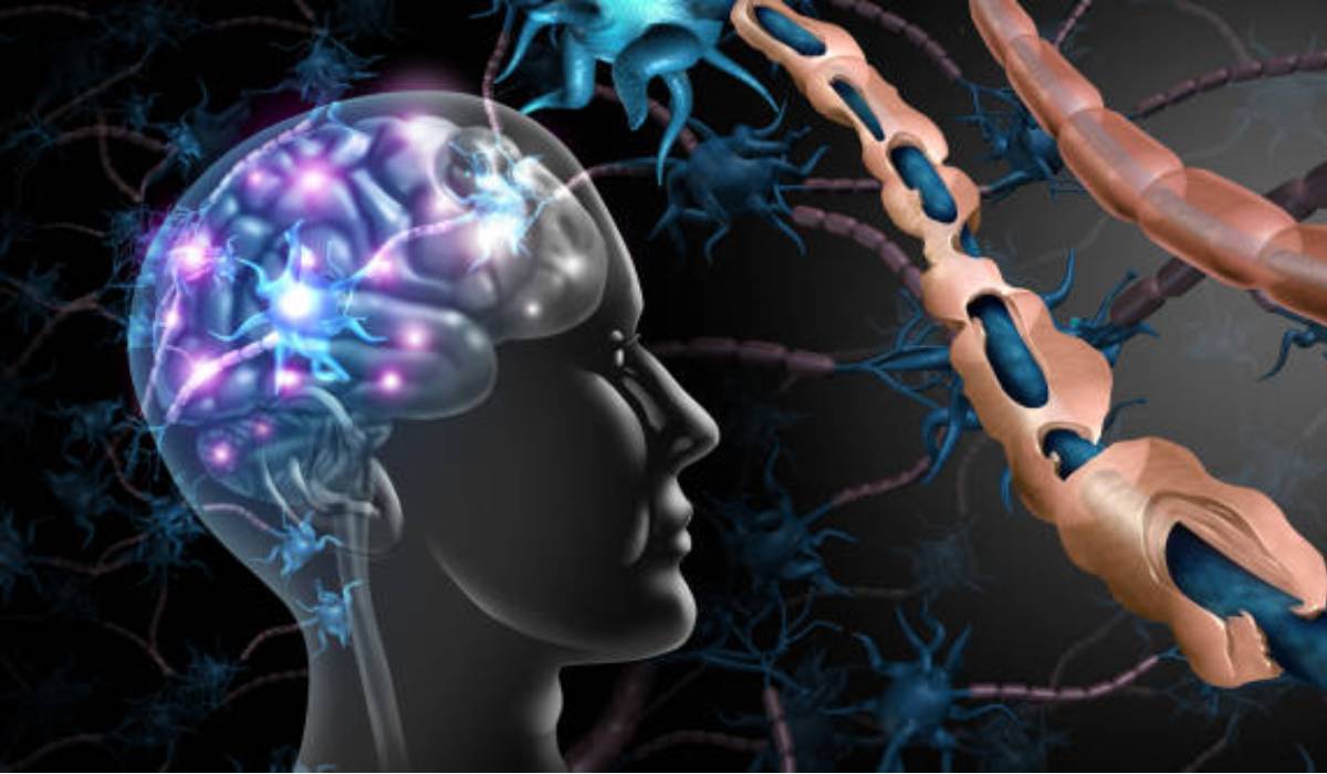 Multipl Skleroz Hastalığı