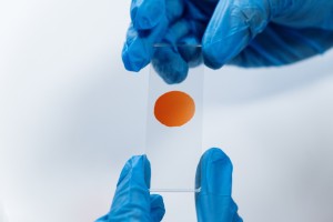 HPV DNA Pozitif,  Pap Test Negatif  Hastalarda Takip