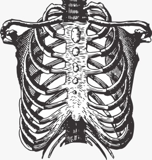 Kostokondrit (Tietze)