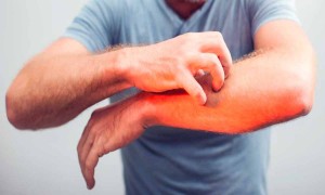 Kaşıntının Nedeni