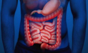 Hirschsprung Hastalığı