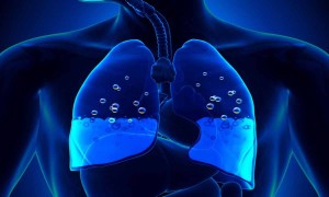 Akciğerlerde Sıvı Toplanması (Pulmoner Ödem)