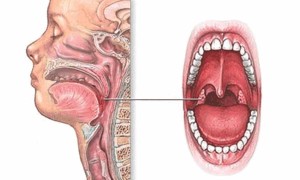 Bademcik Ve Burun Eti Ameliyatları