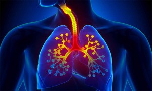 Bronşektazi: Bronş Genişlemesi