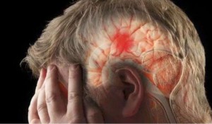 BDH Hastalığı Nedir?