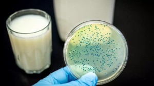 Brusella Hastalığı Nedir?