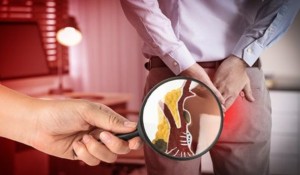 Hemoroidal Hastalık Nedir?