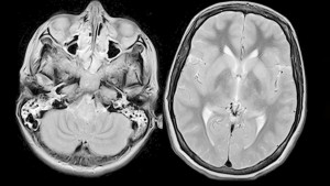 Kuduz Olan Sudan Neden Korkar?