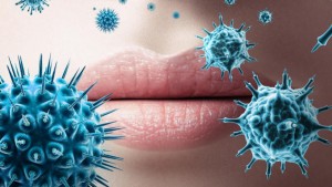 Herpes Simpleks Virüsü Nedir?