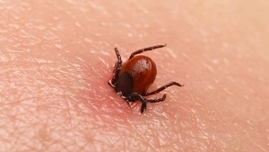 Kulunç Hastalığı Nedir?